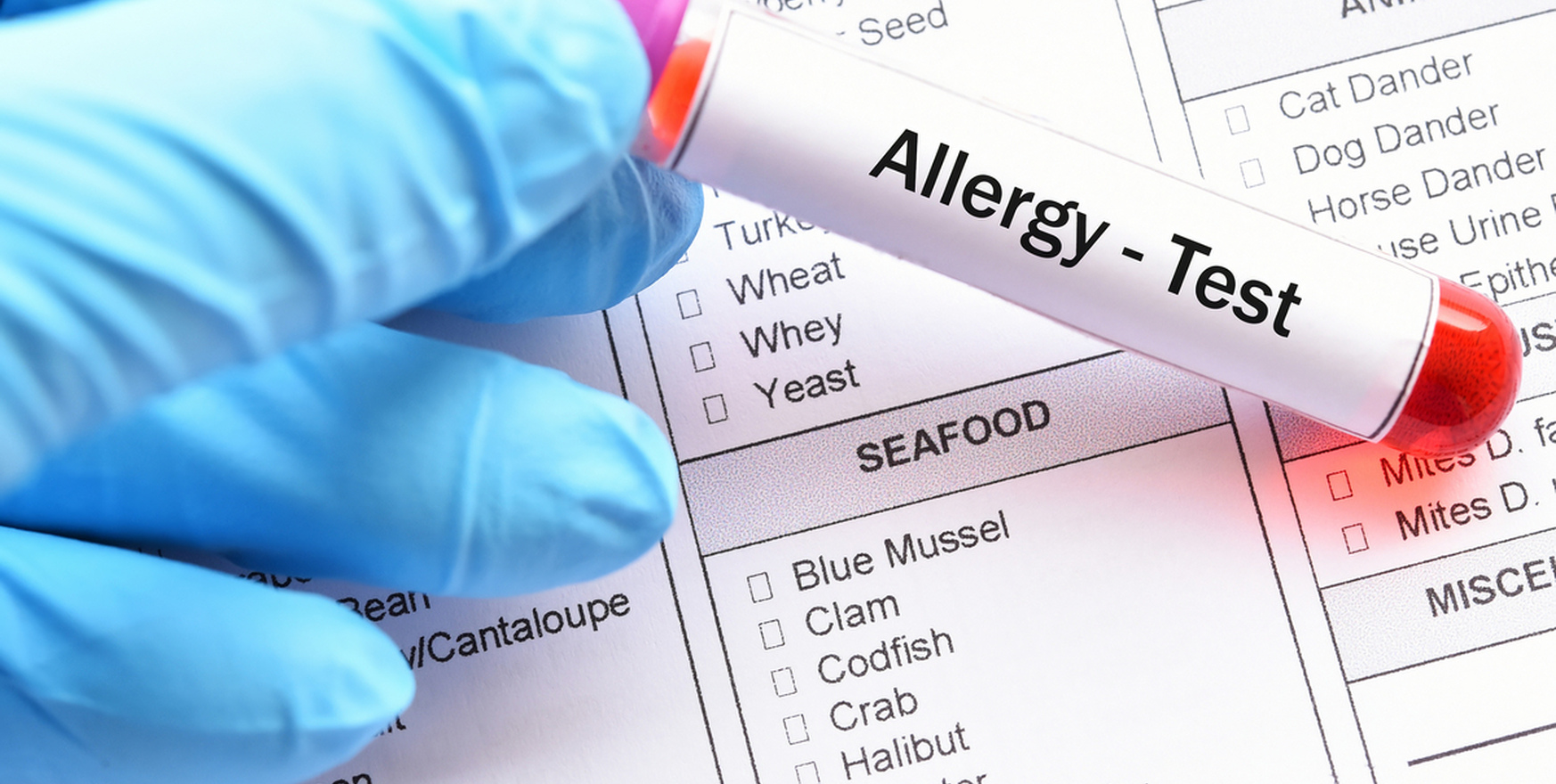 Provocative tests for allergens